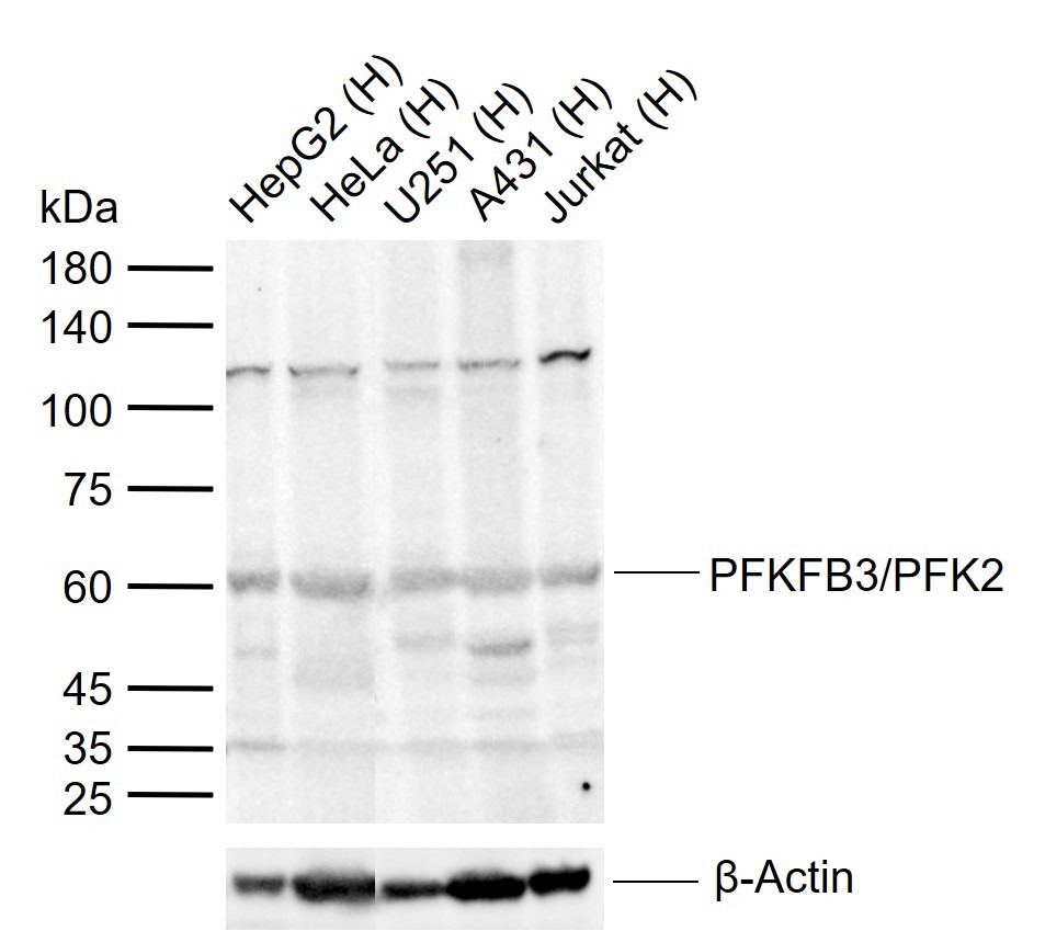 Anti-PFKFB3 Polyclonal Antibody