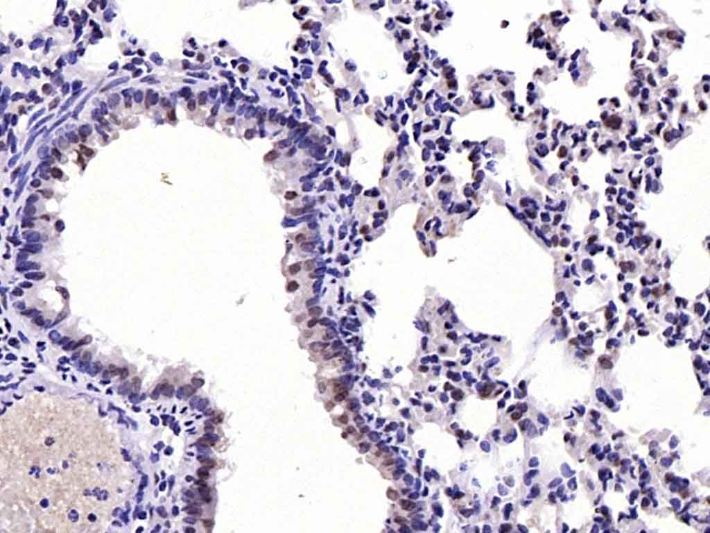 Anti-Phospho-FOXO1 (Ser256) Polyclonal Antibody