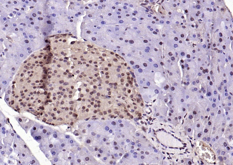 Anti-Phospho-ERK1/2 (Thr202 , Tyr204) Polyclonal Antibody