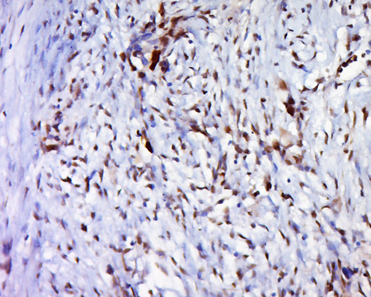Anti-Phospho-FOXO1 (Ser319) Polyclonal Antibody