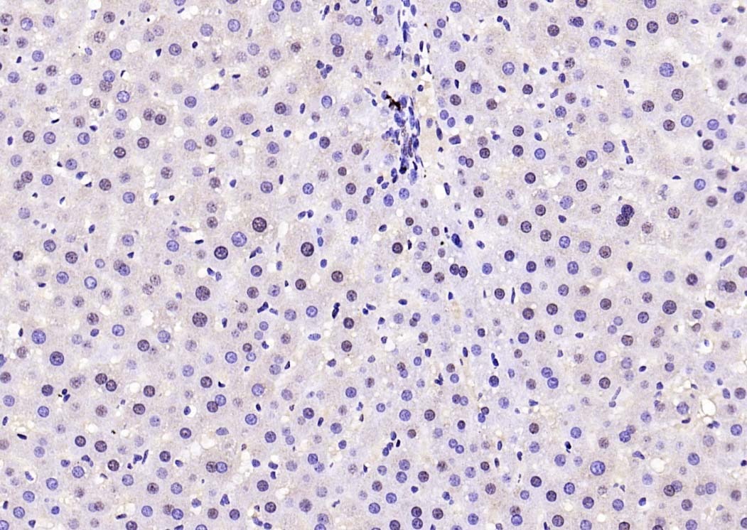 Anti-Phospho-FOXO1 (Ser319) Polyclonal Antibody