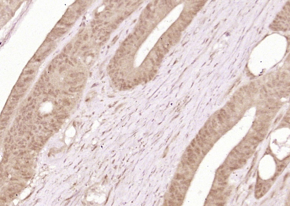 Anti-Phospho-ERK5 (Ser496) Polyclonal Antibody