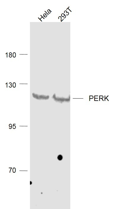 Anti-PERK Polyclonal Antibody