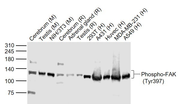 Anti-Phospho-FAK (Tyr397) Polyclonal Antibody