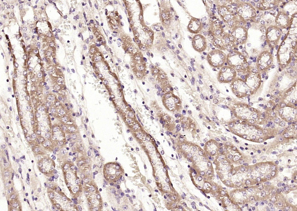 Anti-PFKM Polyclonal Antibody