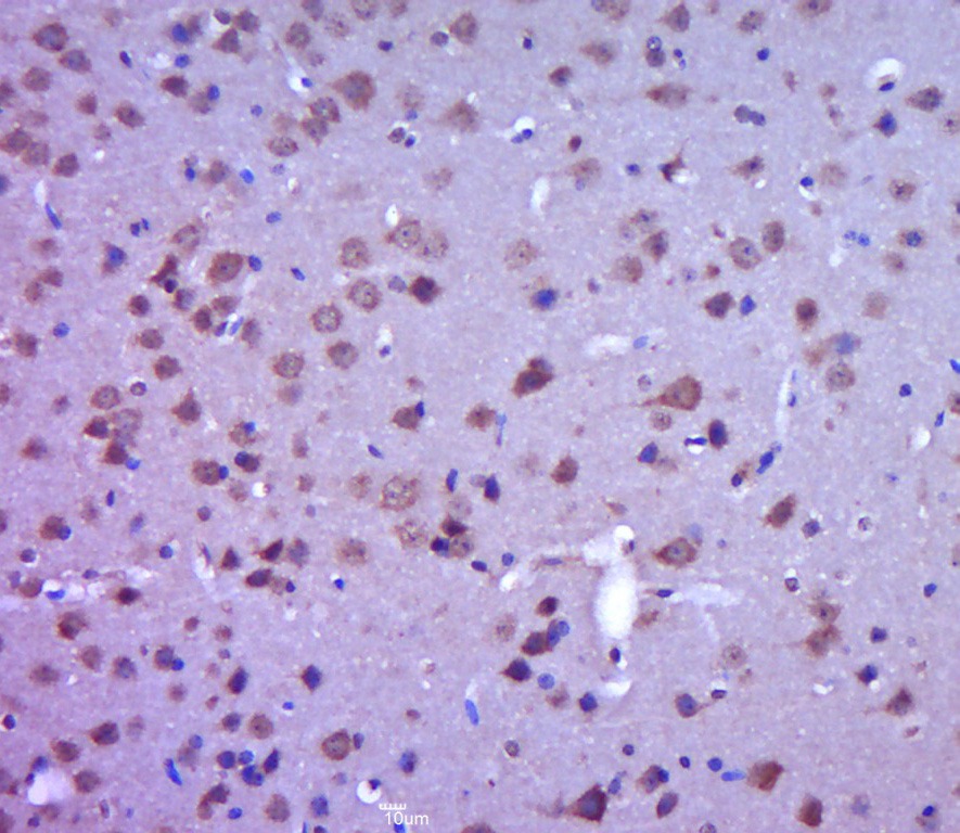 Anti-Phospho-FAK (Tyr397) Polyclonal Antibody
