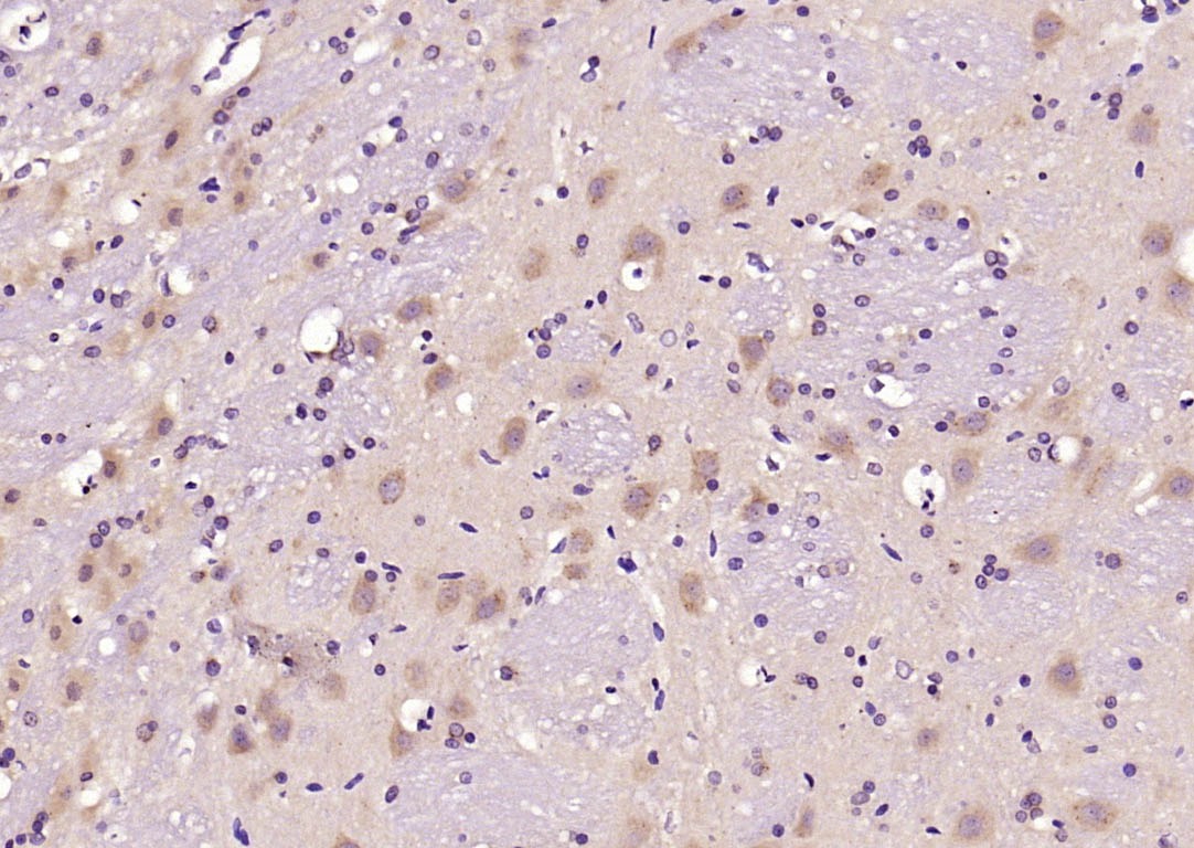 Anti-PERK Polyclonal Antibody