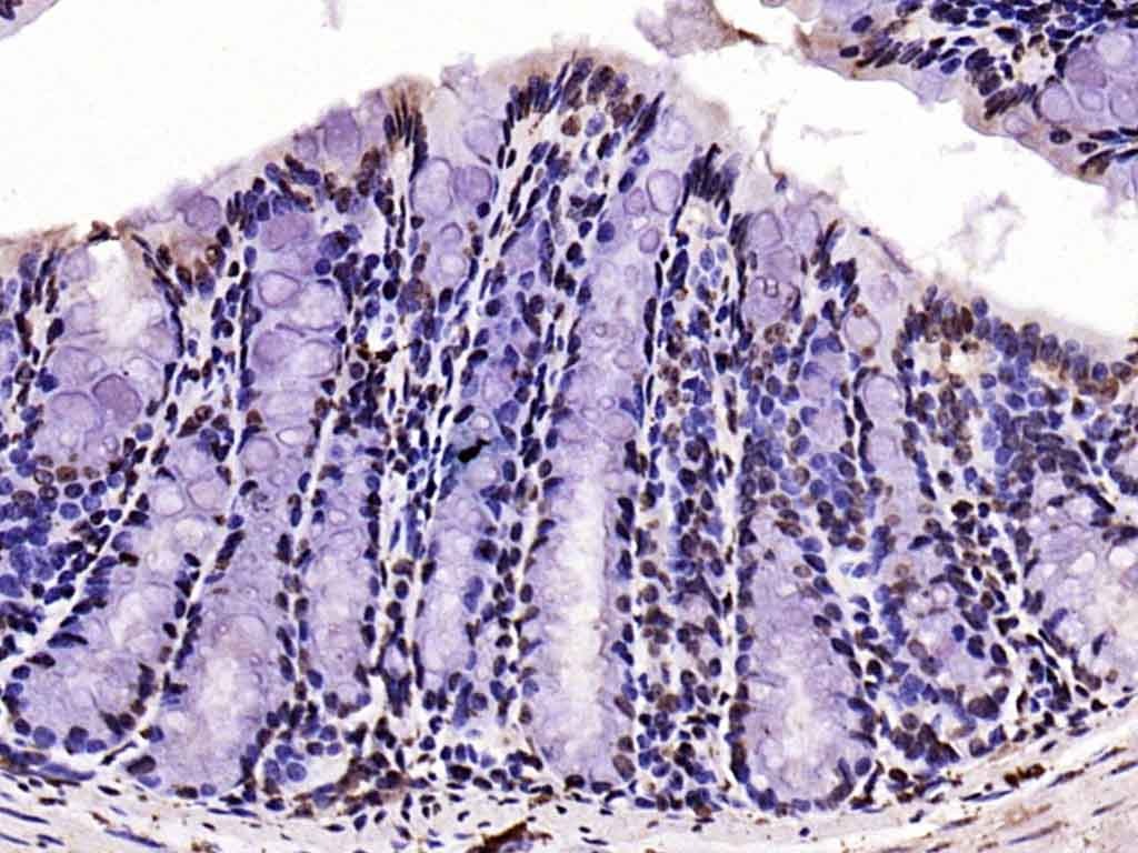 Anti-Phospho-FOXO1 (Ser256) Polyclonal Antibody