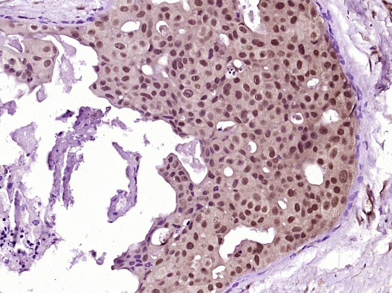 Anti-Phospho-AKT (Ser473) Antibody (9L992)