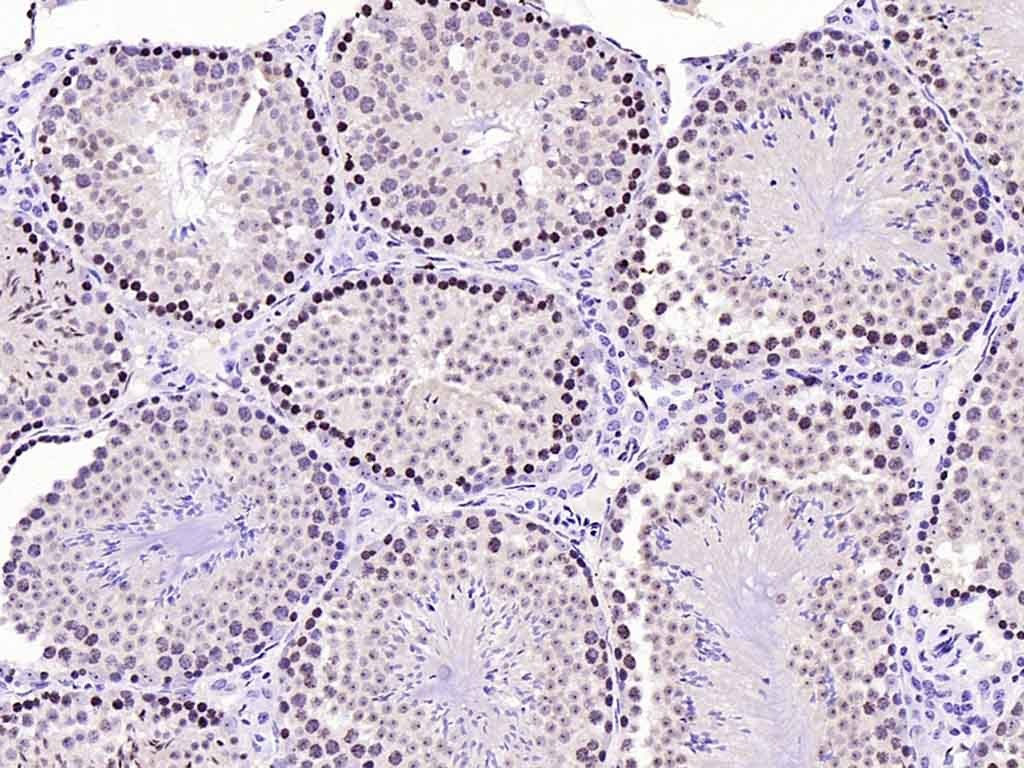 Anti-Phospho-FOXO1 (Ser256) Polyclonal Antibody