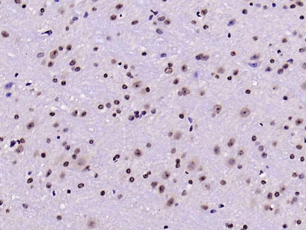 Anti-Phospho-FOXO1 (Ser256) Polyclonal Antibody