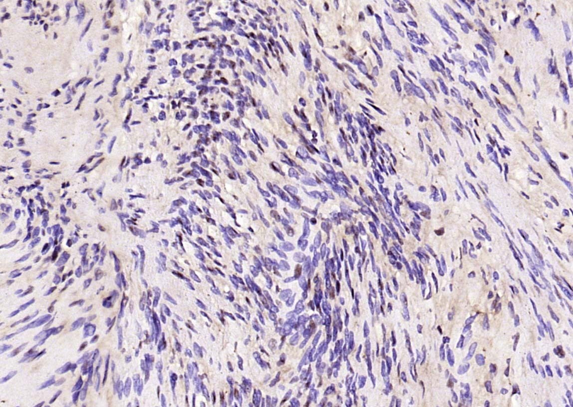 Anti-Phospho-ERK1/2 (Thr202 , Tyr204) Polyclonal Antibody