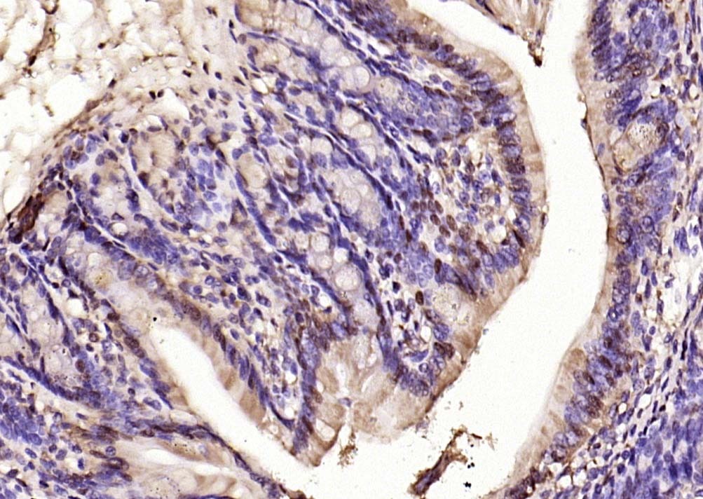 Anti-Phospho-ERK1/2 (Thr202 , Tyr204) Polyclonal Antibody