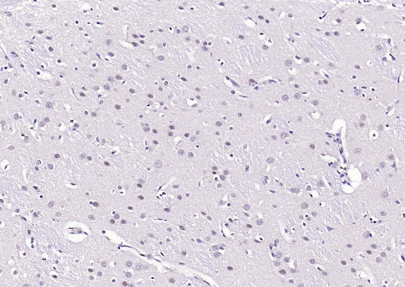 Anti-Phospho-AKT (Ser473) Antibody (9L992)