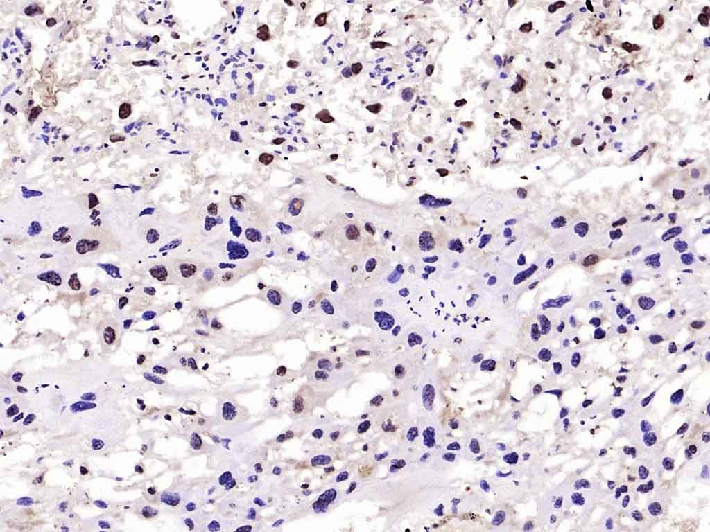 Anti-Phospho-FOXO1 (Ser256) Polyclonal Antibody