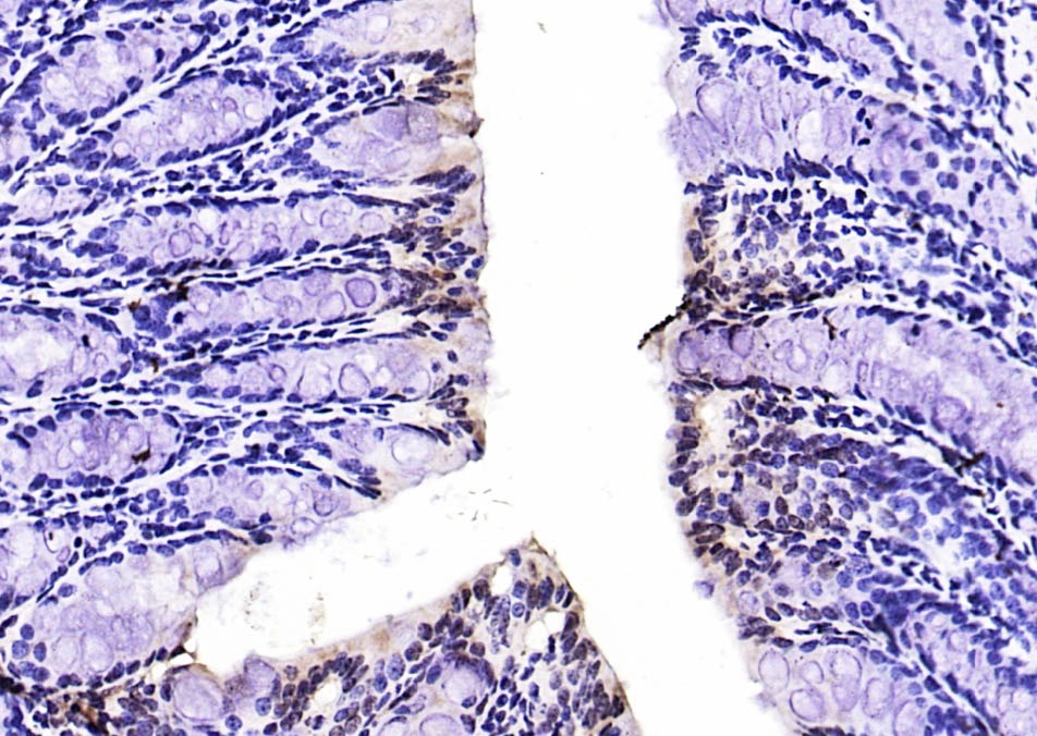 Anti-Phospho-FOXO1 (Ser319) Polyclonal Antibody