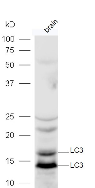 Anti-MAP1LC3A Polyclonal Antibody