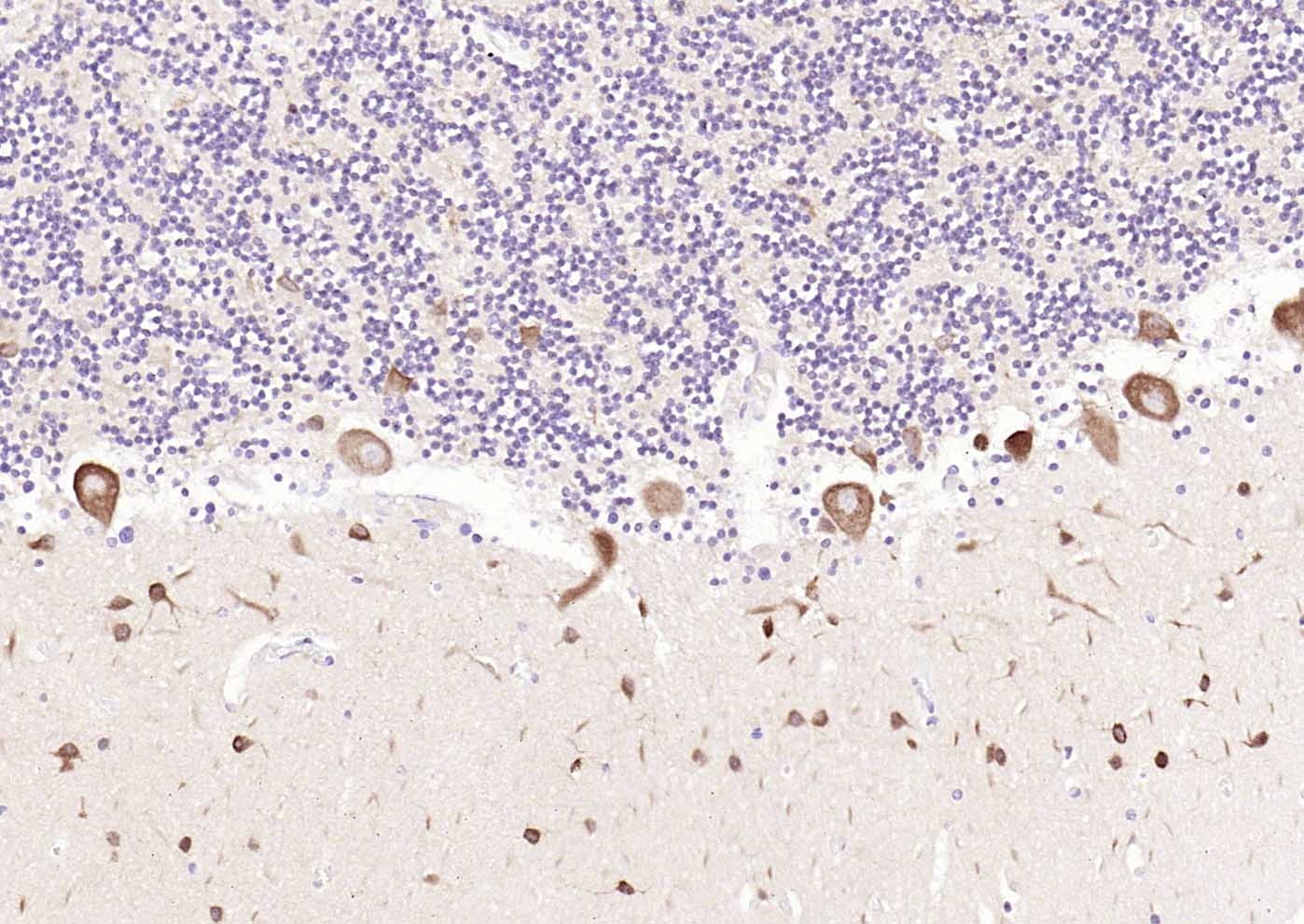 Anti-LC3A Antibody (4U976)