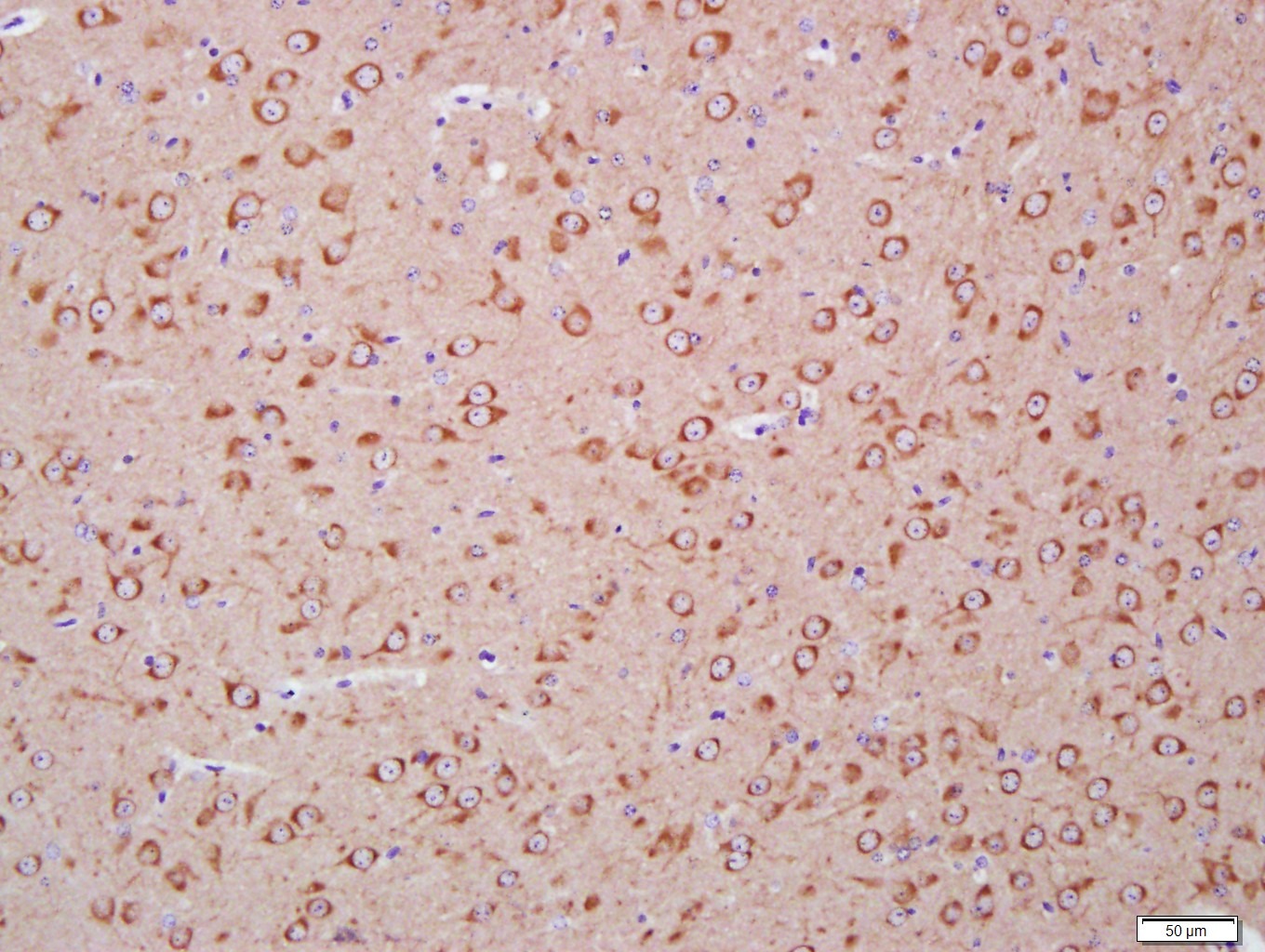 Anti-LC3A Antibody (4U976)
