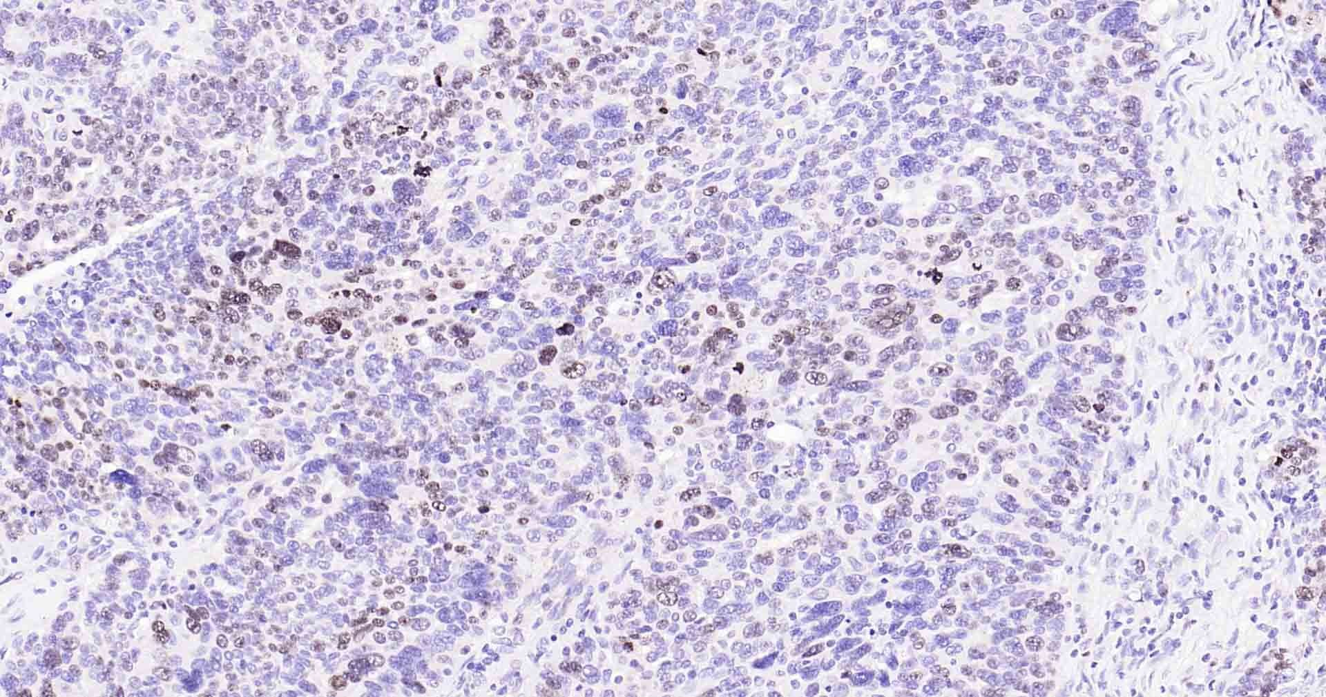 Anti-MKI67 Antibody (3A821)