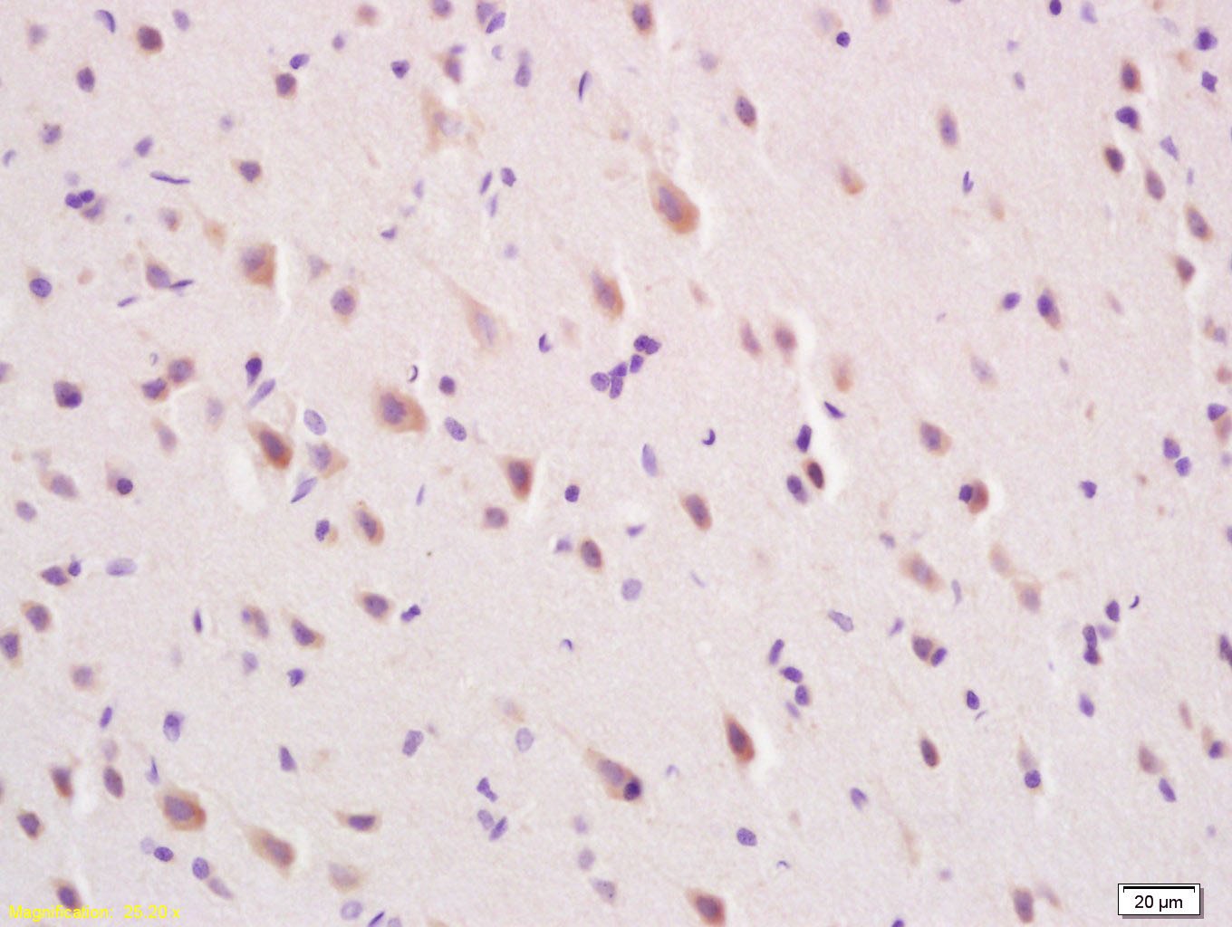 Anti-MFSD2A Polyclonal Antibody