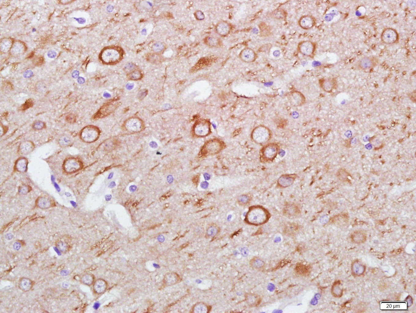 Anti-LC3A Antibody (4U976)