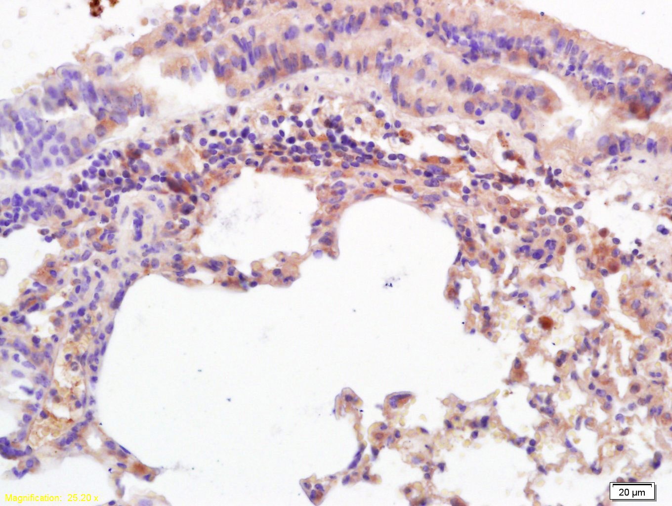 Anti-MICA Polyclonal Antibody