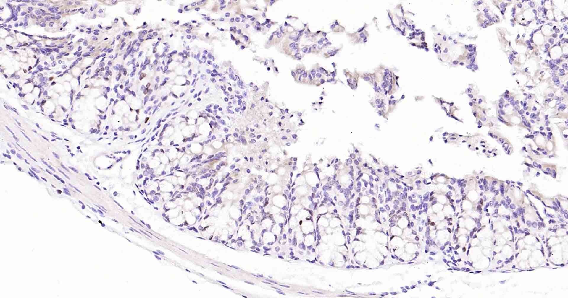 Anti-MKI67 Antibody (3A821)