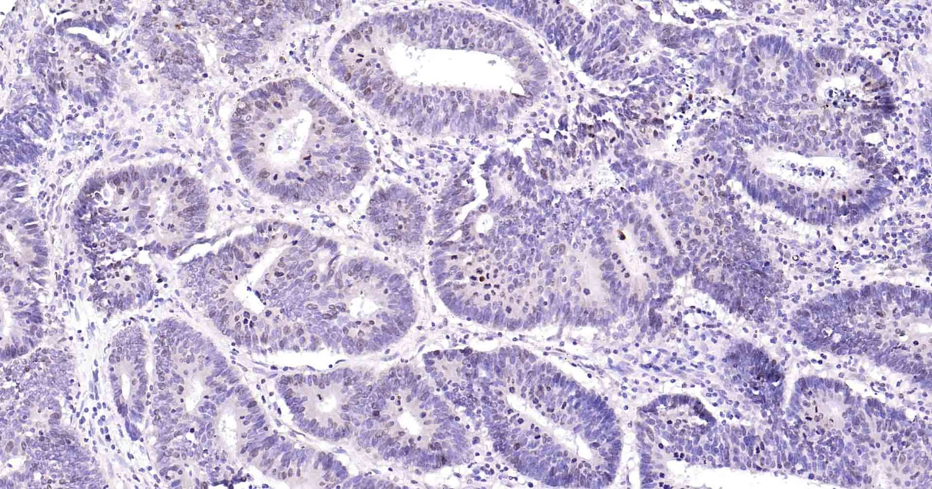 Anti-MKI67 Antibody (3A821)