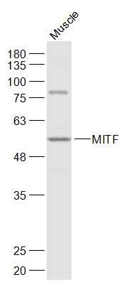 Anti-MITF Polyclonal Antibody