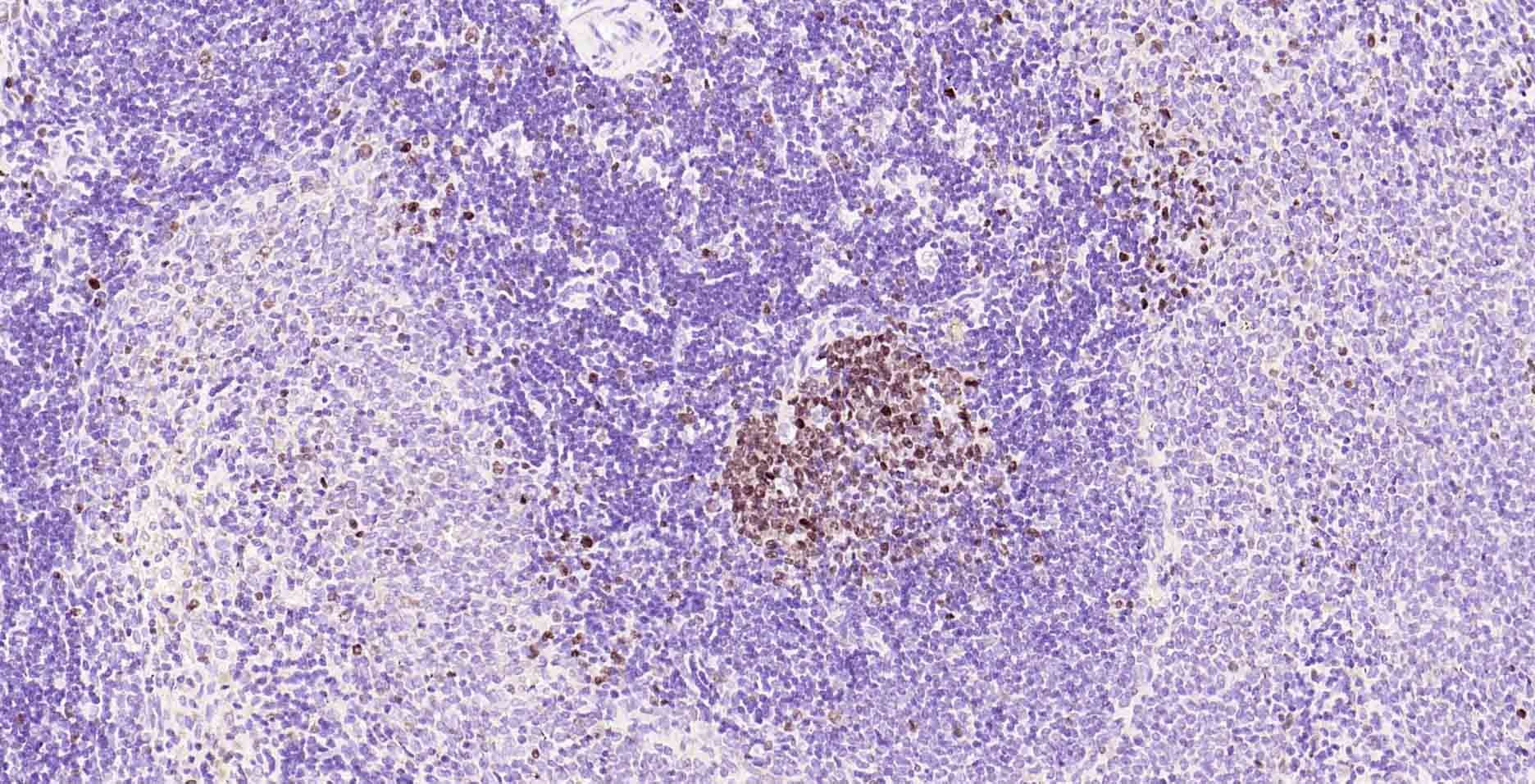 Anti-MKI67 Antibody (3A821)