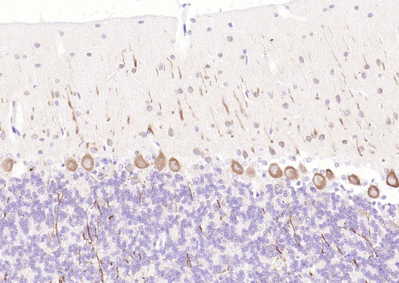 Anti-LC3A Antibody (4U976)