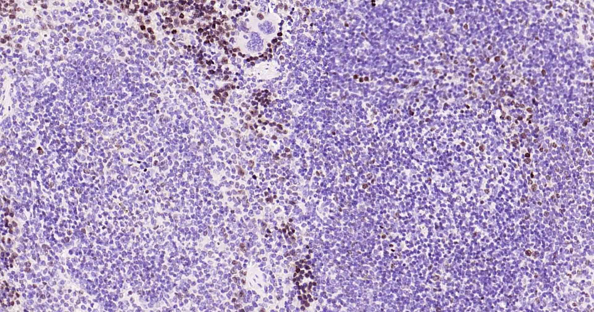 Anti-MKI67 Antibody (3A821)