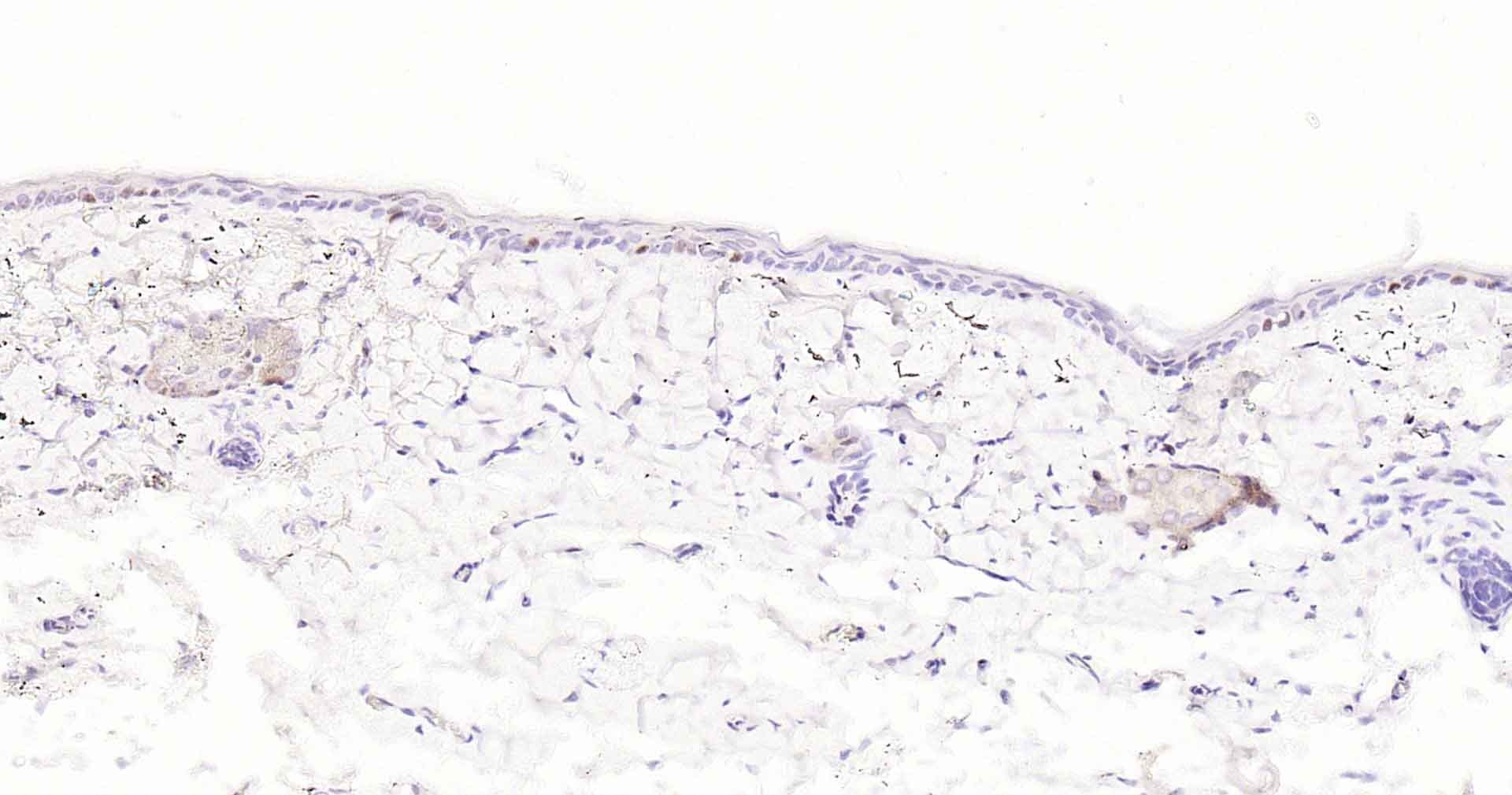 Anti-MKI67 Antibody (3A821)