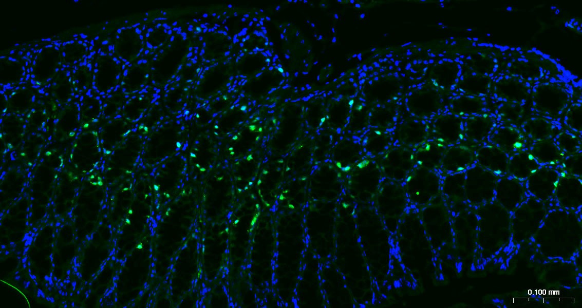 Anti-MKI67 Antibody (3H14)