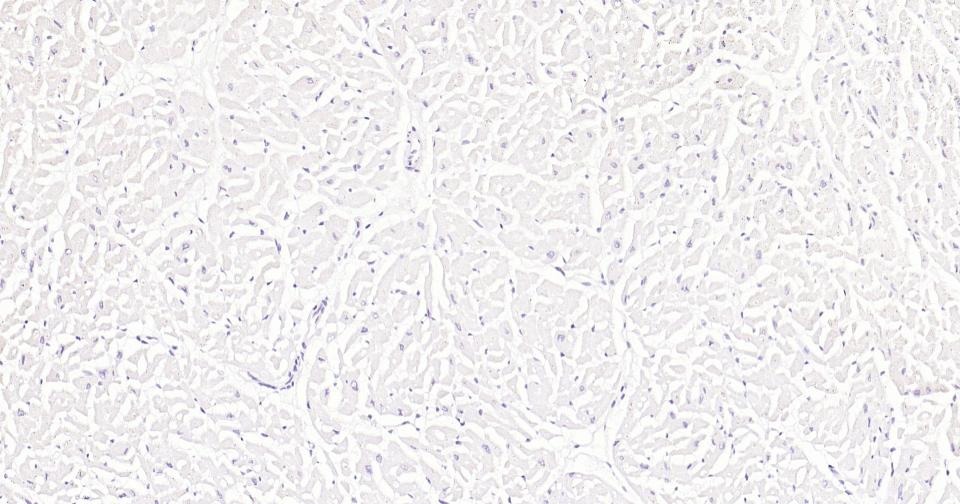 Anti-MKI67 Antibody (3H14)