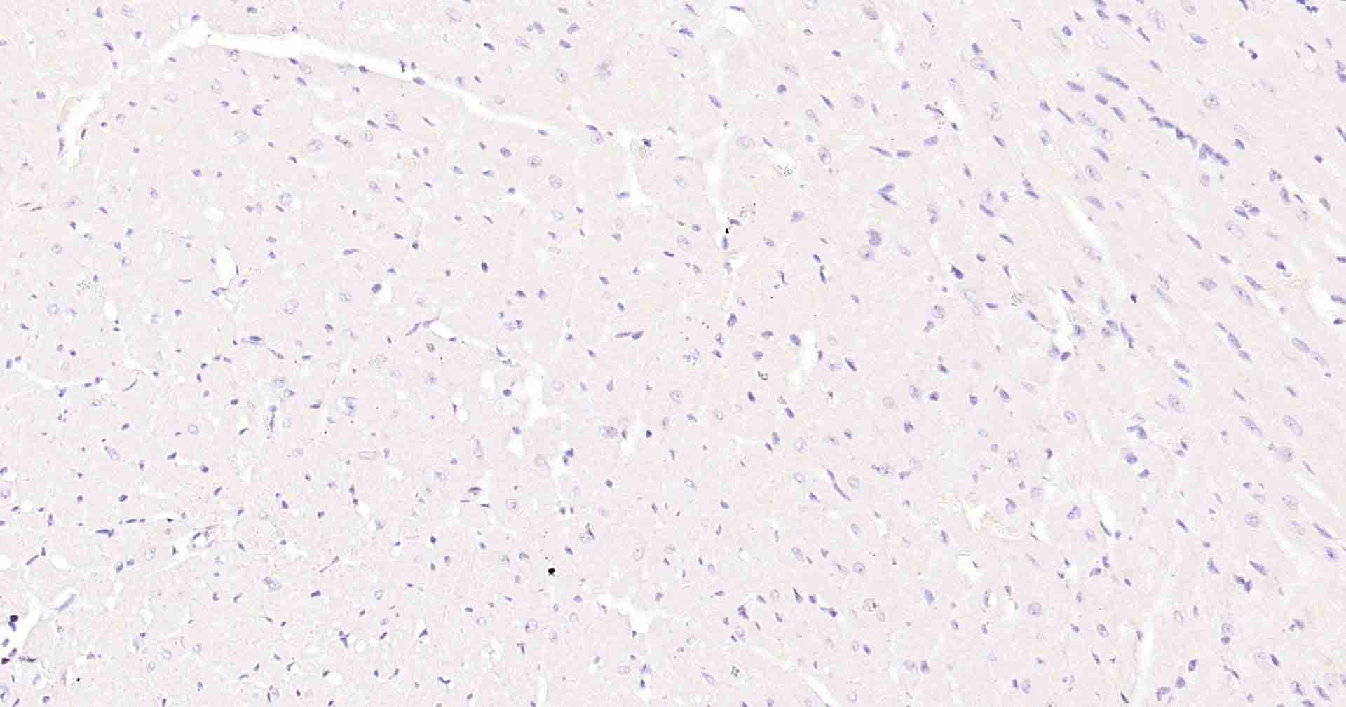 Anti-MKI67 Antibody (3A821)
