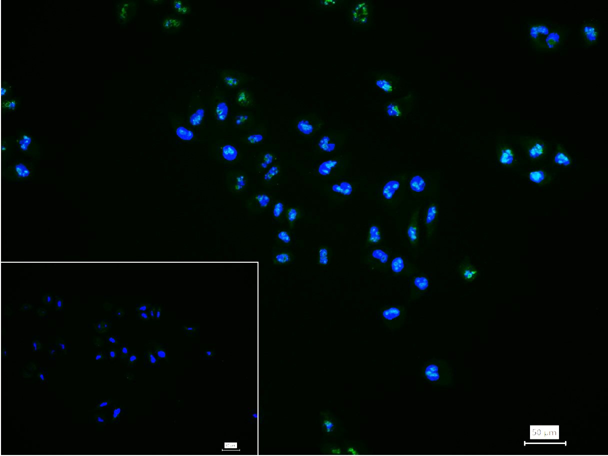 Anti-MKI67 Antibody (3H14)