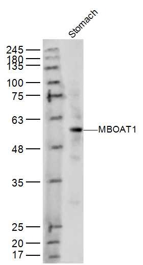 Anti-MBOAT1 Polyclonal Antibody