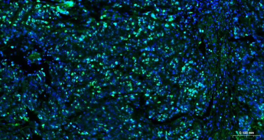 Anti-MKI67 Antibody (3H14)