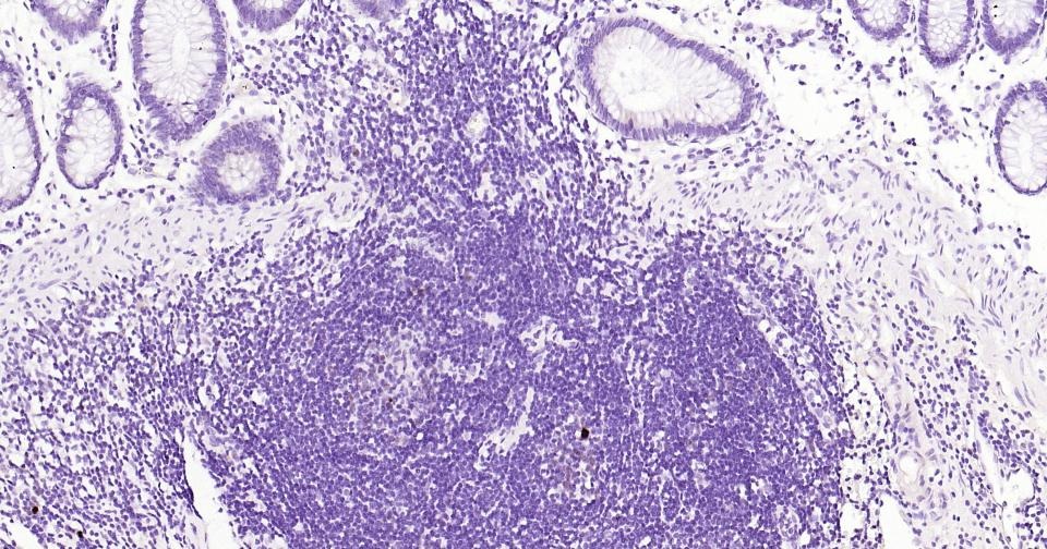 Anti-MKI67 Antibody (3H14)