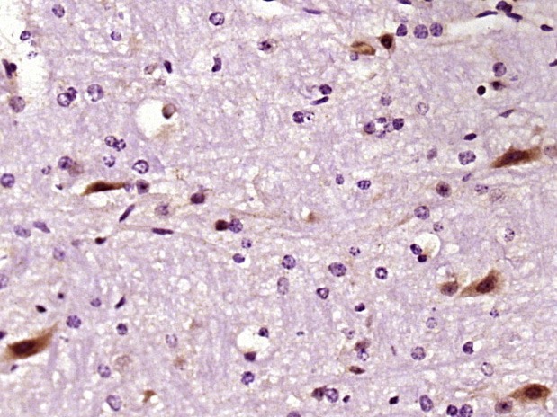 Anti-LIMK1 Polyclonal Antibody