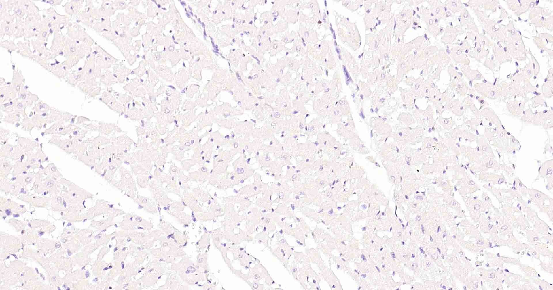 Anti-MKI67 Antibody (3A821)