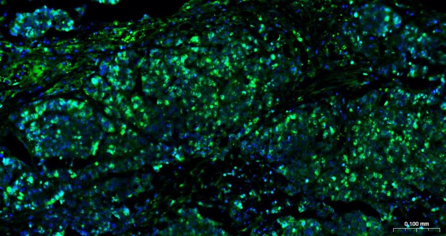 Anti-MKI67 Antibody (3A821)