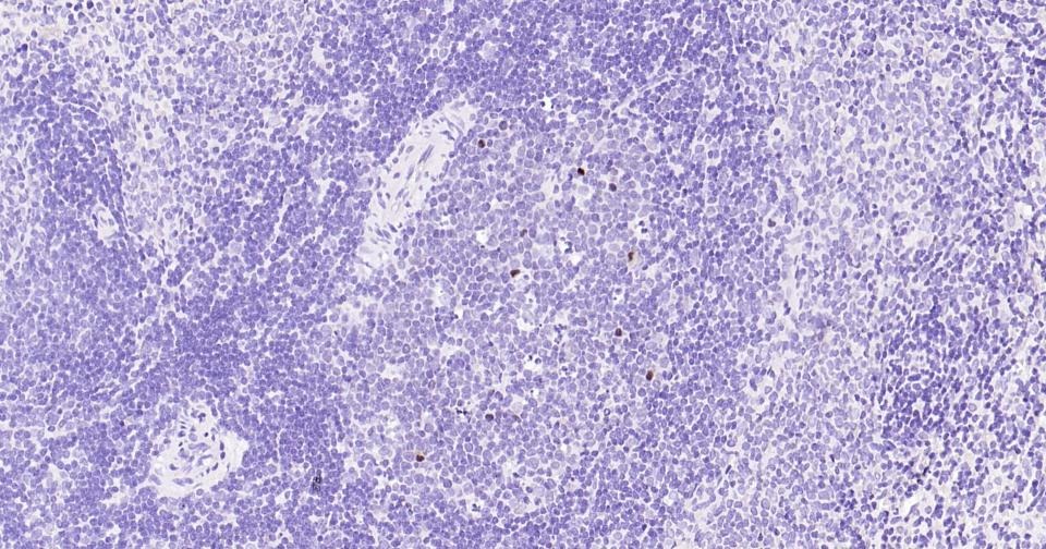 Anti-MKI67 Antibody (3H14)