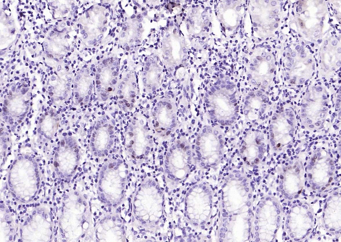 Anti-MKI67 Polyclonal Antibody 2
