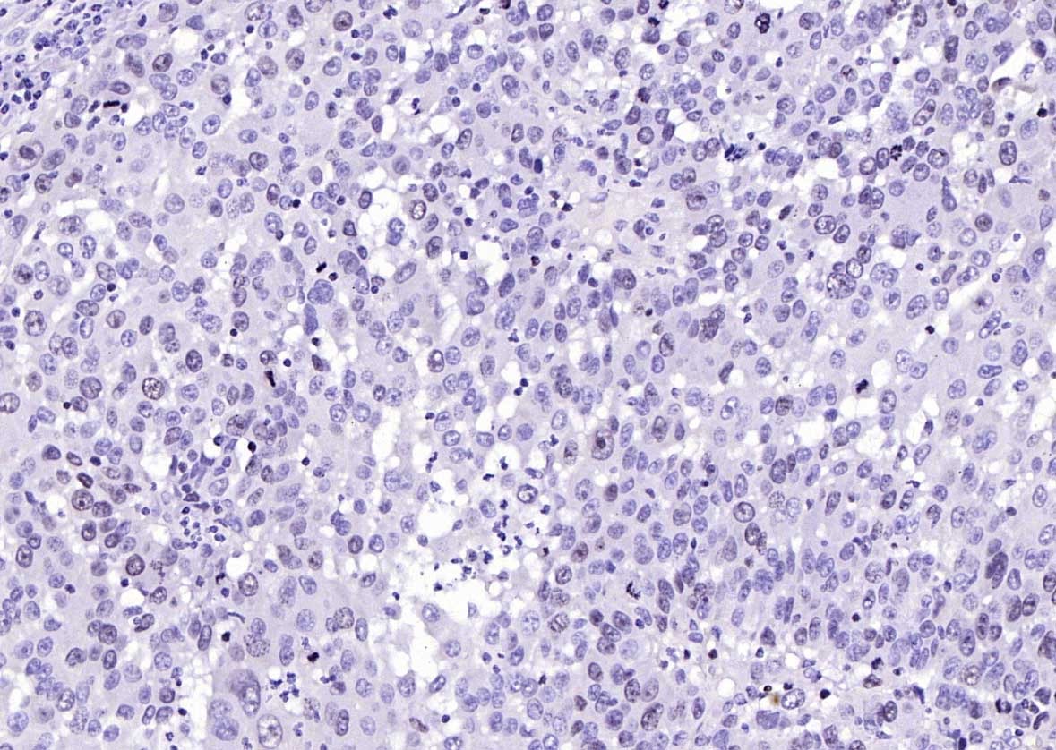 Anti-MKI67 Polyclonal Antibody 2