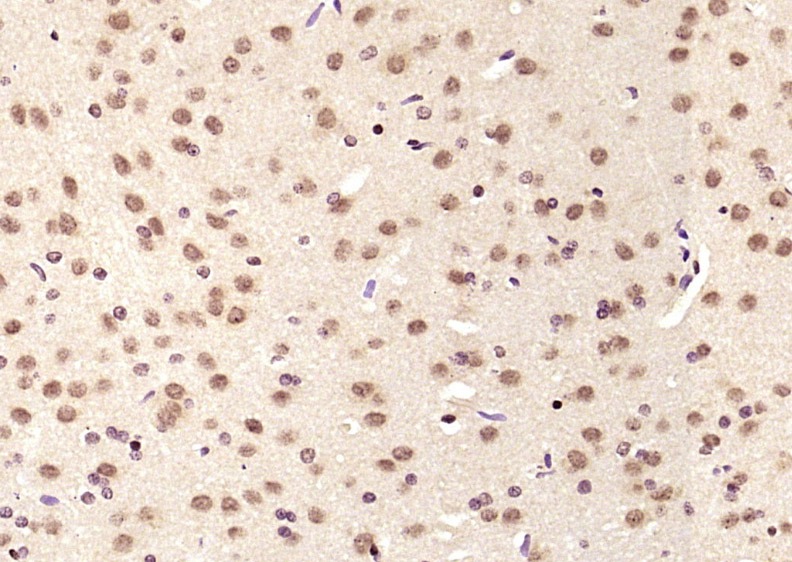 Anti-LIMK1 Polyclonal Antibody