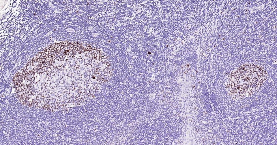 Anti-MKI67 Antibody (3H14)