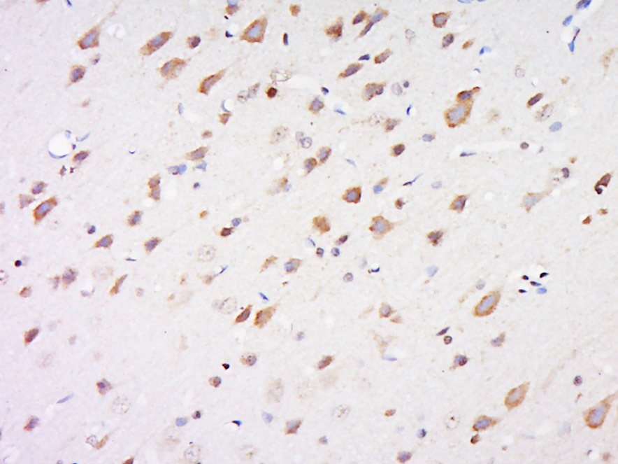 Anti-Lipoprotein lipase Polyclonal Antibody 2